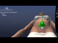 sonosim quickstart how to take a measurement