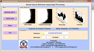 Matlab code for Breast Cancer Detection using image processing
