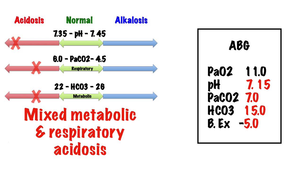 Abg Interpretation Examples