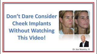 Don't Dare Have Cheek Implants without Watching This Video