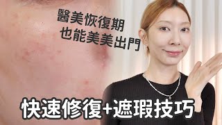 醫美恢復期也能美美出門《快速修護+遮瑕技巧》｜Astor