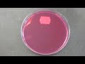 sputum cultures