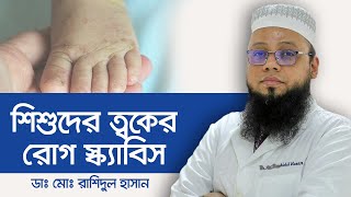 Scabies | Scabies Treatment | Scabies Symptoms | খোস পাঁচড়া ও তার প্রতিকার