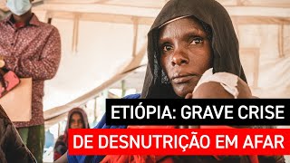 Grave crise de desnutrição em Afar, Etiópia: aumento da assistência é urgente