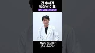 간수치가 높은 원인