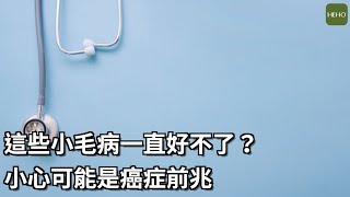 這些小毛病別輕忽！６個常見的癌症前兆｜健康小撇步