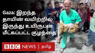 Israel Hamas போரில் மொத்த குடும்பமும் பலி; தாயின் வயிற்றில் உயிர் தப்பித்த குழந்தை