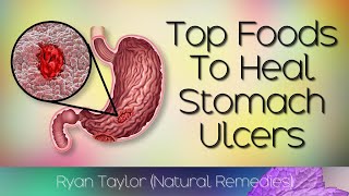 Foods To Cure Stomach Ulcers (Natural Remedies)