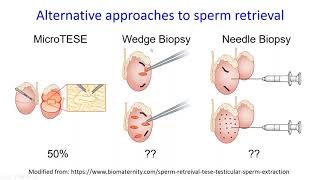 Grand Rounds- Spermatogenesis and Male Fertility