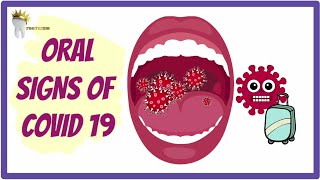 Why Do Signs of COVID 19 Appear in the Oral Cavity?