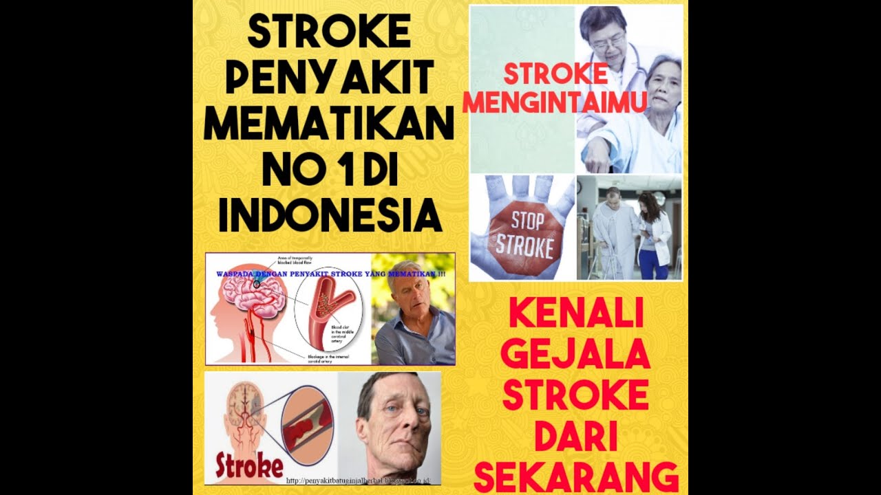 BAHAYA STROKE DAN TIPS MENCEGAH STROKE - YouTube