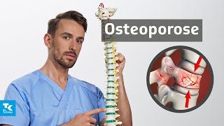 Osteoporose (Knochenschwund) verstehen: Ursachen, Symptome, Diagnose & Therapie | DocTommy