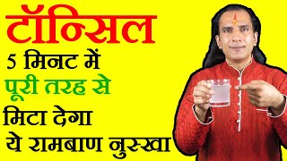 टाँसिल का घरेलू नुस्खा How To Cure Tonsils - tonsil ka ilaj - gale mein dard in Hindi - Sachin Goyal