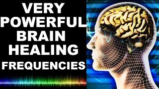 EXTREME BRAIN HEALING FREQUENCIES: FOR STUDY, FOCUS, MIND POWER, CONFIDENCE, MEDITATION : MUST TRY !