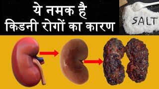 ये नमक है किडनी की  बीमारी का असली कारण | Health inning