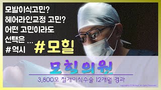 [모힐TV] 강남모발이식 어떤고민이라도 선택은 역시 모힐 3,800모 절개이식수술 12개월 경과영상