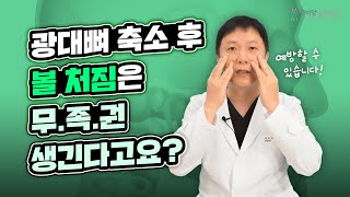 [안면윤곽] \