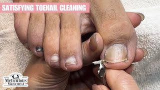 How to Clean Toenails Properly at Home Step by Step to Prevent Ingrown Nail