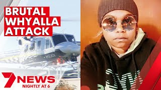 Whyalla woman fighting for life after alleged brutal bashing | 7NEWS