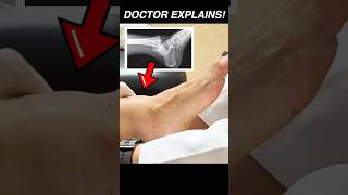 Reduction of an Ankle Dislocation | Doctor Explains! #anatomy #medicalstudent #emergency #medicine