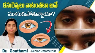 Ptosis Causes \u0026 Treatment | Droopy Eyelid | కన్ను రెప్పలు వాలిపోతున్నాయా | Best Vision Eye Hospital