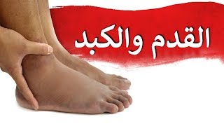 ماذا تخبرك القدم عن صحة الكبد | تسعة أعراض | دكتور بيرج