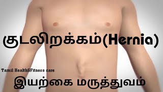 Hernia treatment in Tamil | குடலிறக்கம் இயற்கை மருத்துவம்