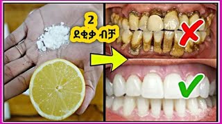 በሁለት ደቂቃ ጥርስ ነጭ ለማድረግ ቀላል ዘዴ[How To Whiten Teeth at Home in 3 Minutes]