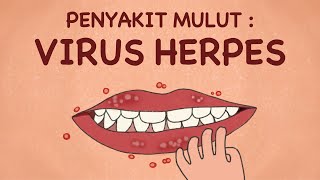 Virus Herpes : Bibir Gatal dan Ada Bintik-Bintik Isinya Air