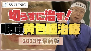 【2023年最新版】切らずに治す！眼瞼黄色腫治療