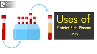 Uses of Platelet Rich Plasma PRP - Dr. Yusuff Shariff