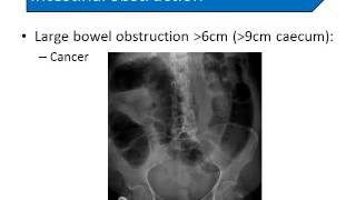 08/04/14 Lower abdominal conditions