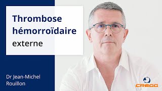 3 réponses sur la thrombose hémorroïdaire externe