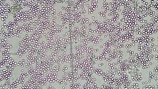 Yeast Under 40X Objective Lens