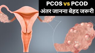 PCOD & PCOS Difference: क्या दोनों एक हैं ? फर्क जानना है जरूरी ताकि आप रहें Healthy | Jeevan Kosh