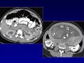 ct and mr evaluation of the pregnant patient fetal and maternal indications