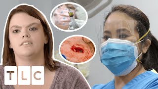 Dr. Lee Concerned Cyst Removal Surgery May Cause Brain Damage! I Dr Pimple Popper