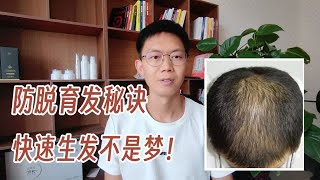 雅斯汀洗发水真的可以防脱发吗，分享我的防脱生发秘诀。