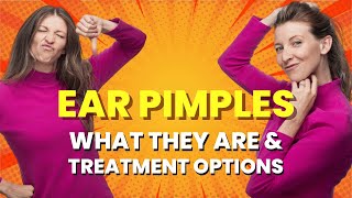 Ear Pimples: What They Are, How to Treat, and Prevent Them!