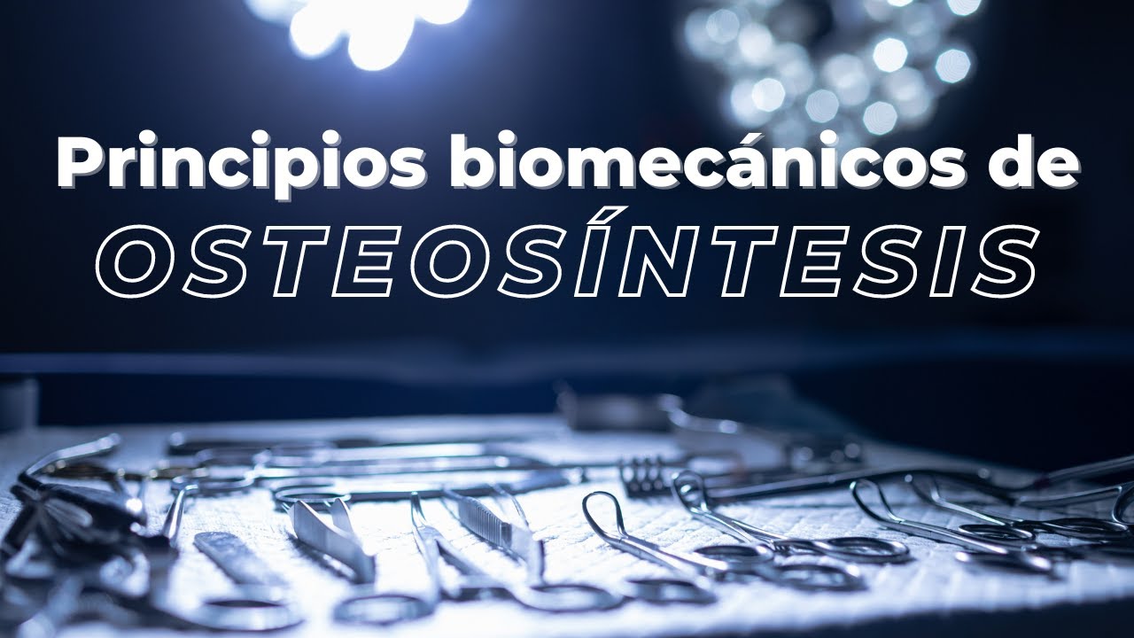 Principios Biomecánicos En Osteosíntesis - YouTube