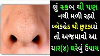 બ્લેકહેડ થી કાયમી છુટકારો | Remove Blackheads At Home | Home Remedies | Hitesh Sheladiya