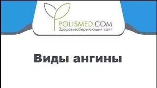 Виды ангины (тонзиллита) односторонняя и двусторонняя, острая и хроническая. Рецидив ангины