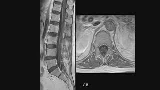 2021 Neuroradiology in Clinical Practice - A CME Teaching Activity