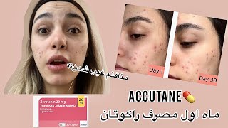 Accutane journey 1st month ماه اول راکوتان چه اتفاق هایی افتاد؟