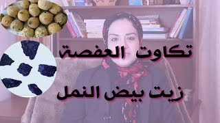 العفصة تاكاوت وزيت بيض النمل