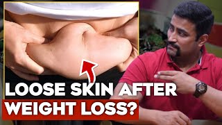 Get Rid of Loose & Flabby Skin After Weight Loss !!