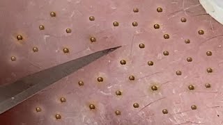Satisfying Relaxing with Sac Dep Spa Video (#180)
