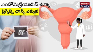 Endometriosis : ఎండోమెట్రియాసిస్ ఉన్నవారికి పిల్లలు పుట్టరా ? | Dr.Kranti Silpa @MedPlusONETV