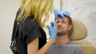 Male BOTOX® Treatment from Start to Finish | Weiler Plastic Surgery