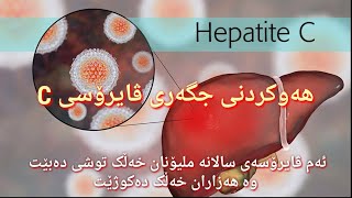 ھەوکردنی جگەری ڤایرۆسی C( Hepatitis C Virus)